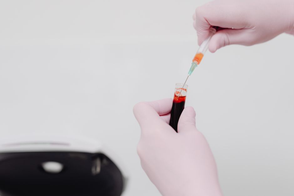 What Blood Tests and Warning Signs Should I Discuss Before Taking Supplements for Hair Shedding?